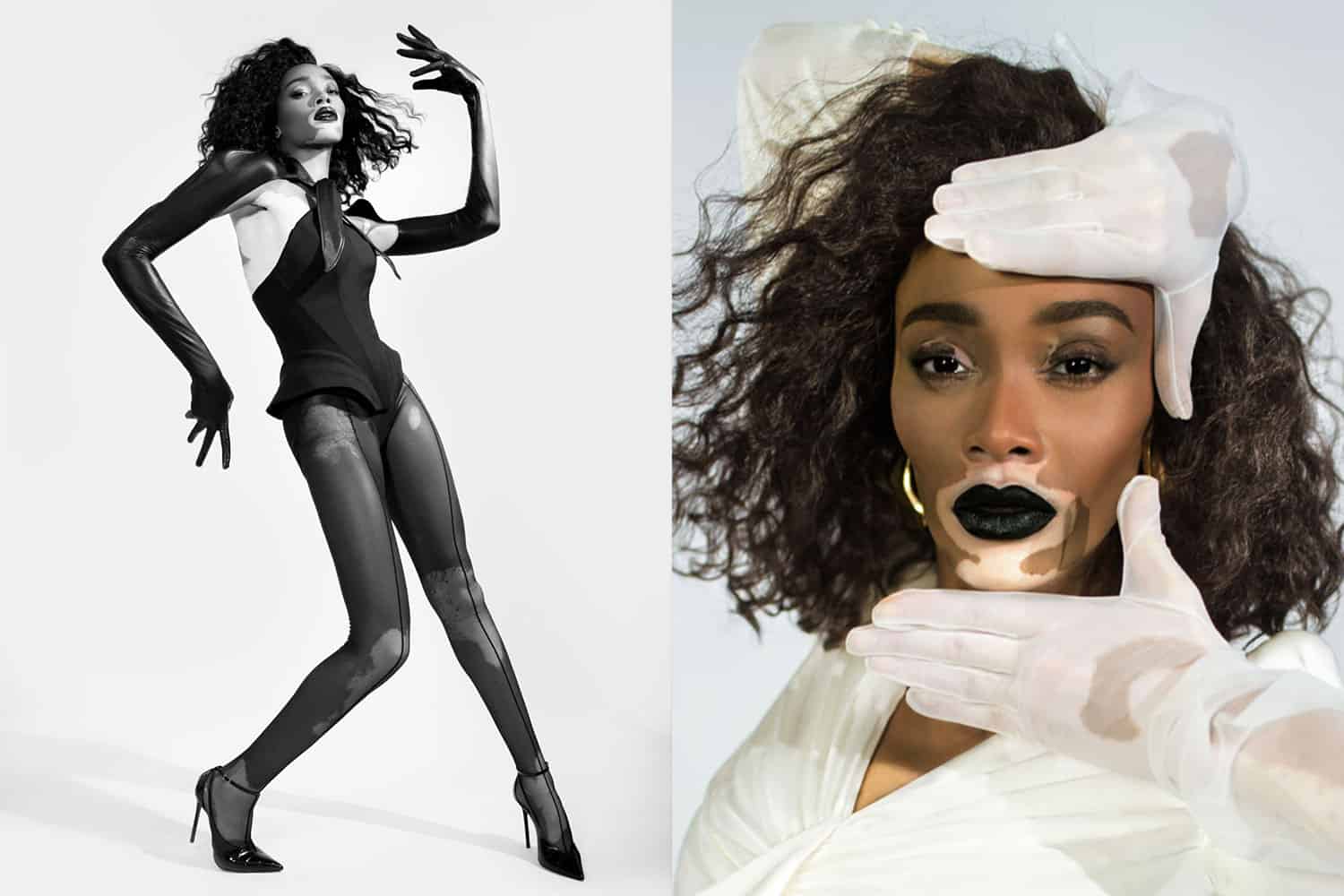 Winnie harlow pictures